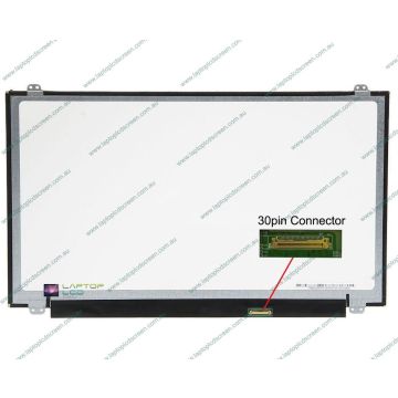 Dell Alienware 15 R3 AW157R1AU Replacement Laptop LCD Screen Panel