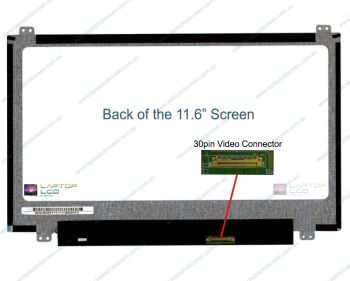 ASUS CHROMEBOOK CZ1104CM2A Replacement Laptop LCD Screen Panel (Non-Touch)